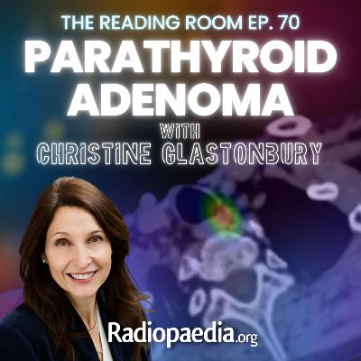 70. Readful! Parathyroid adenoma with Christine Glastonbury