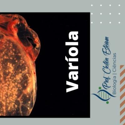 4° Podcast | Varíola