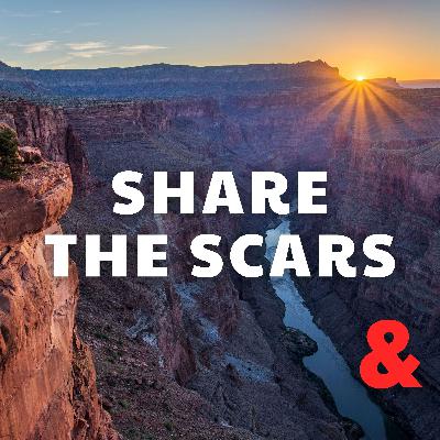 Share the Scars
