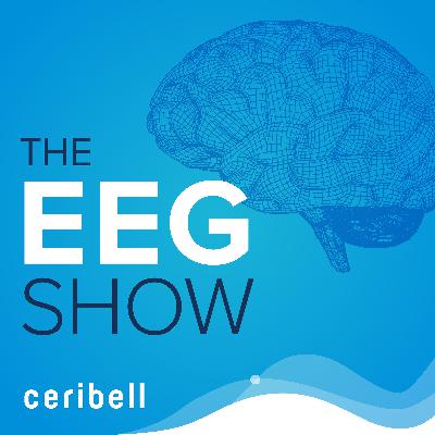 Seizure Detection with Artificial Intelligence (AI) enabled EEG with James Quinn, MD