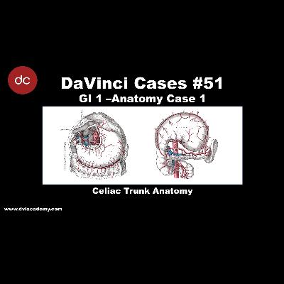 Celiac Trunk Anatomy Case [#DaVinciCases GI 1 - Anatomy Case 1]