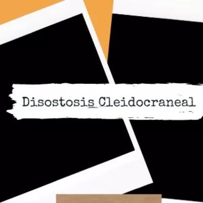 Disostosis Cleidocraneal Disostosis Cleidocraneal
