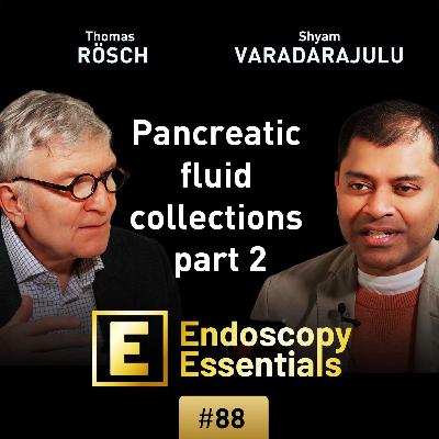 Drainage of pancreatic fluid collections: (2) Access and drainage