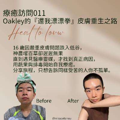 Heal To Love 療癒訪問011 Oakley 的還我漂漂拳皮膚重生之旅