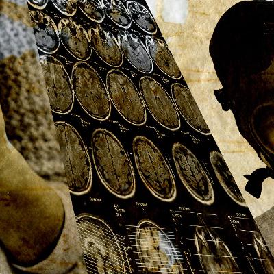 S2 Ep2: Promieniowanie zabija w każdej dawce? - o hormezie i innych rzeczach