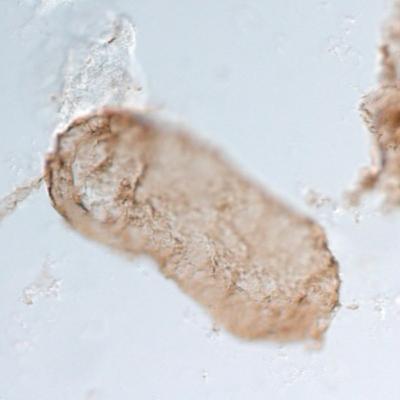Photosynthesis Evolution Clarified by Studying Bacteria Fossils