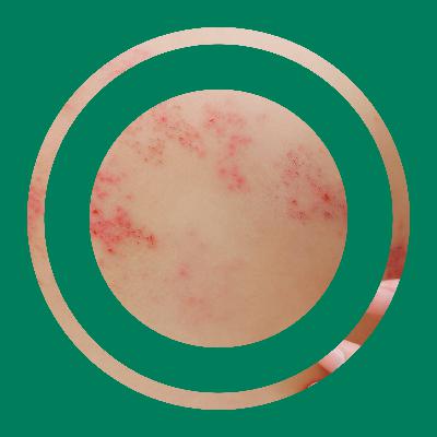 Aflevering 28 - Gordelroos