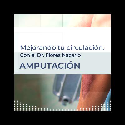 Amputaciones. Amputaciones.