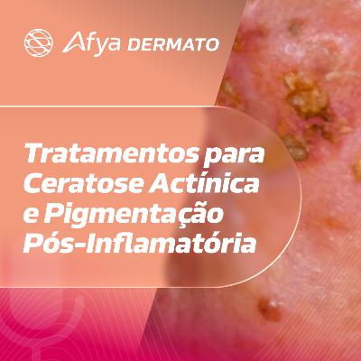 Tratamentos para ceratose actínica e pigmentação pós-inflamatória: avanços práticos?