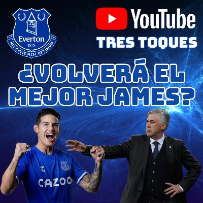 #21: Everton