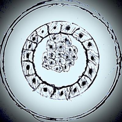 Where does cancer come from?