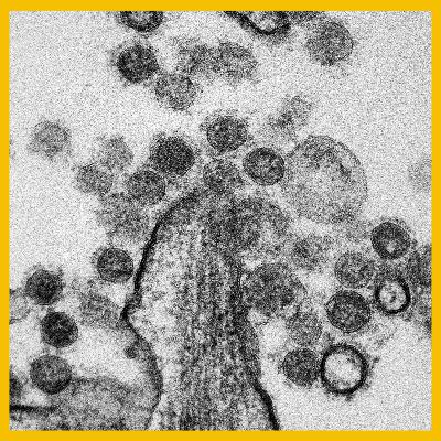 Black Fungus - Symptoms & Treatment Black Fungus - Symptoms & Treatment