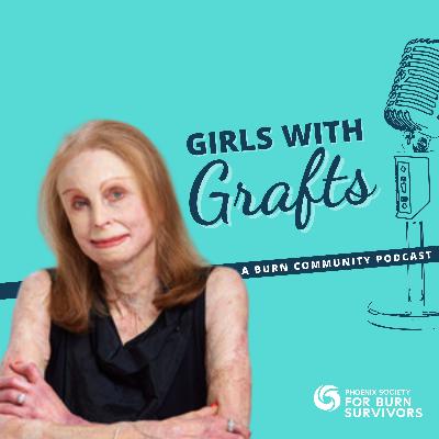 Face Equality Week: Advocating for Authentic Representation in Media with Charlene Pell