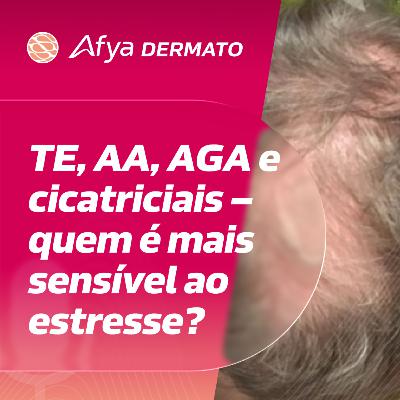 Quais tipos de alopecia mais sofrem impacto do estresse?