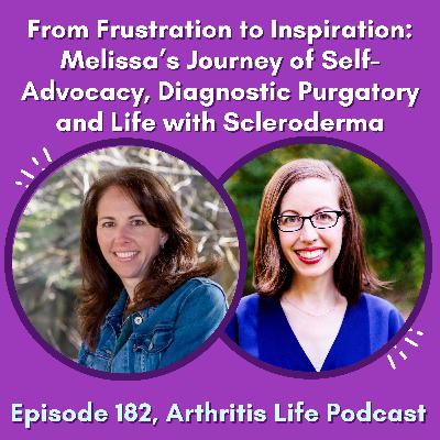 From Frustration to Inspiration: Melissa’s Journey of Self-Advocacy, Diagnostic Purgatory and Life with Scleroderma