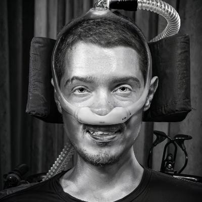 A vida com sindrome de Duchenne - Lucas