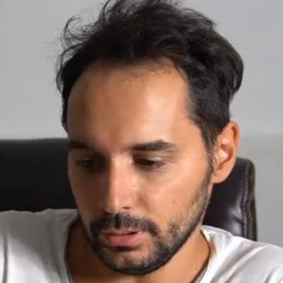 Come fare se hai un difetto fisico importante