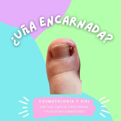 Episodio 6. ¿Uña encarnada?