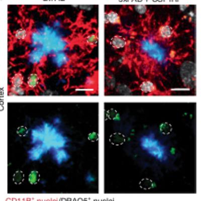 Lymphoid gene expression supports neuroprotective microglia function