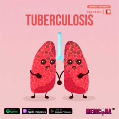 18. Tuberculosis