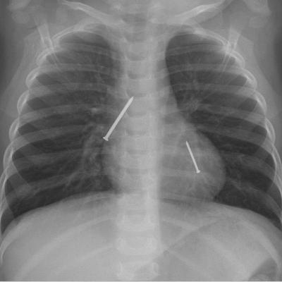 Ep 68: Choking Hazards! Ep 68: Choking Hazards!