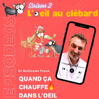 Quand ça chauffe dans l'oeil Quand ça chauffe dans l'oeil