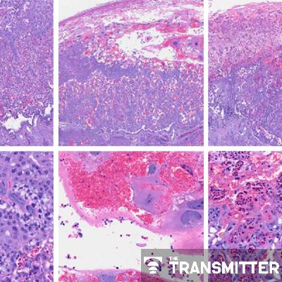 Post-infection immune conflict alters fetal development in some male mice