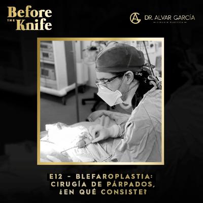 012 - Blefaroplastia: Cirugía de Párpados, ¿en qué consiste?