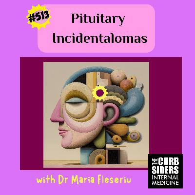 #513 Pituitary Incidentalomas #513 Pituitary Incidentalomas