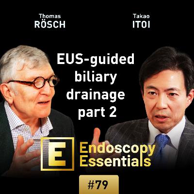 EUS-guided biliary drainage part 2