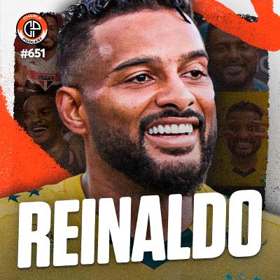 #651 - Reinaldo [Jogador do Mirassol]