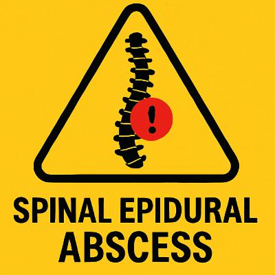 266. Spinal Epidural Abscess... with a twist