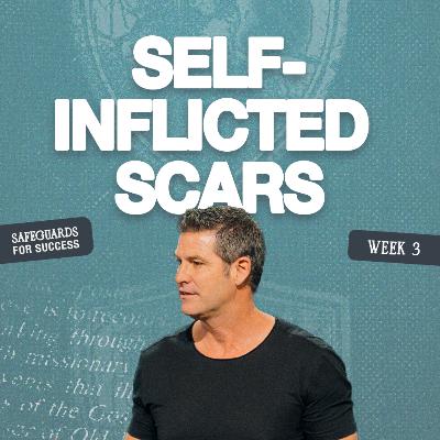 The Pain You Didn’t Have to Have (Safeguards, Part 3)