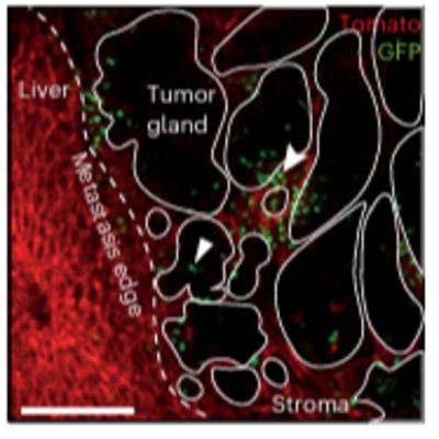TGF-β builds a dual immune barrier in colorectal cancer by impairing T cell recruitment and instructing  immunosuppressive SPP1+ macrophages