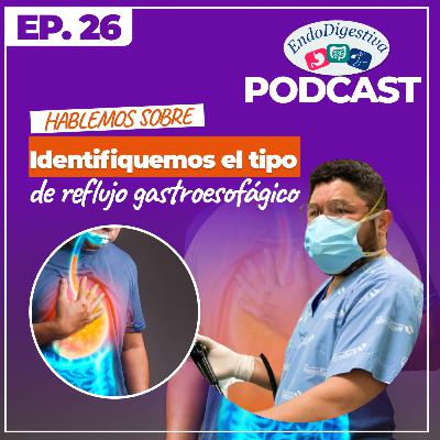 ¿Cómo podemos identificar el reflujo gastroesofágico?