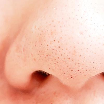 油脂系クレンジングは 毛穴に効く？