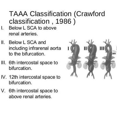 Aortic Aneurysm- Vascular Surgery