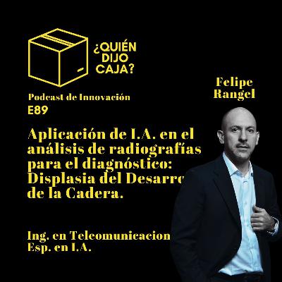 E89 Aplicación de I.A. en el análisis de radiografías en Displasia del Desarrollo de Cadera. E89 Aplicación de I.A. en el análisis de radiografías en Displasia del Desarrollo de Cadera.