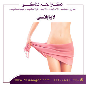 جراحی زیبایی واژن لابیاپلاستی