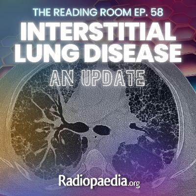 58. Lung HRCT update with Miranda Siemienowicz, Jonathan Chung & Jeffrey Kanne