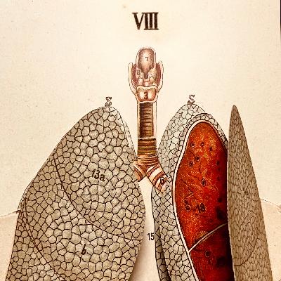 EPSA is Burning S27 E08 - Episodio exclusivo para mecenas
