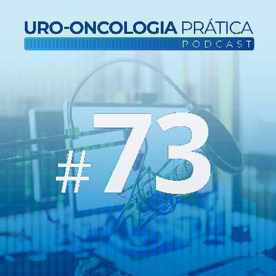 Uro-Oncologia Prática 73 - Prática atual do Hipofracionamento para a Radioterapia do Câncer de Próstata