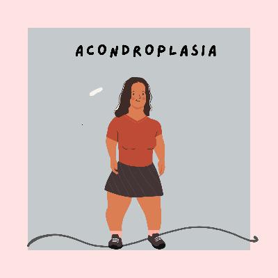 Acondroplasia