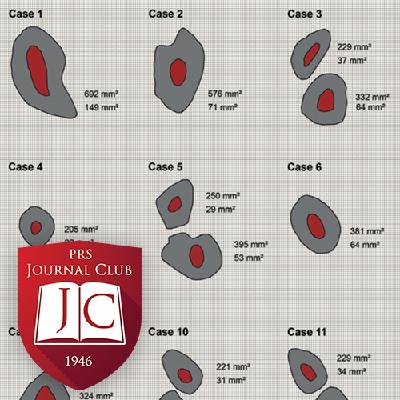 "Total Ear Reconstruction" with Scott P. Bartlett, MD - Feb. 2026 Journal Club "Total Ear Reconstruction" with Scott P. Bartlett, MD - Feb. 2026 Journal Club