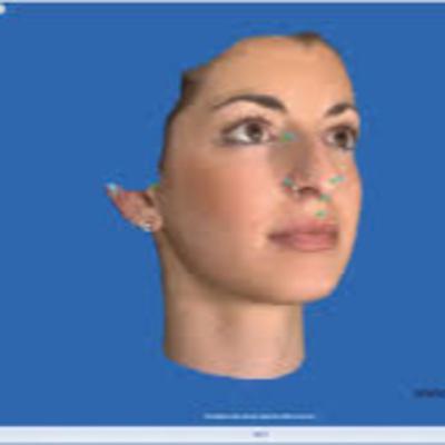 History of Skin Grafting