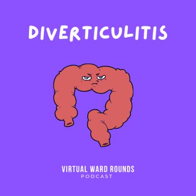 Diverticulitis - Presentation, Investigations and Imaging Diverticulitis - Presentation, Investigations and Imaging