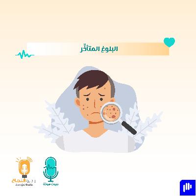 البلوغ المتأخر