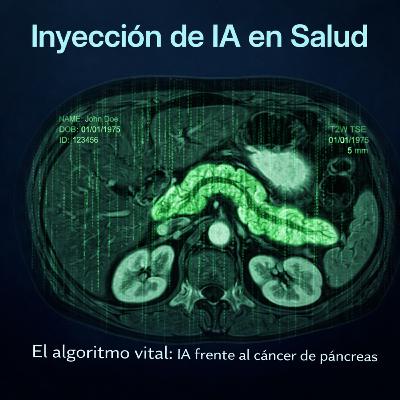 El algoritmo vital: IA frente al cáncer de páncreas