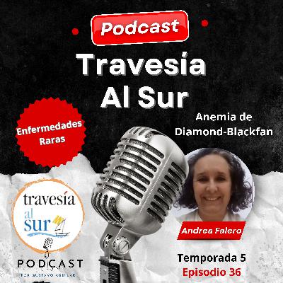 Anemia de Diamond Blackfan