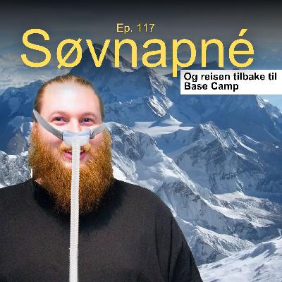 Ep. 117 - Søvnapné er en høylytt morder Ep. 117 - Søvnapné er en høylytt morder